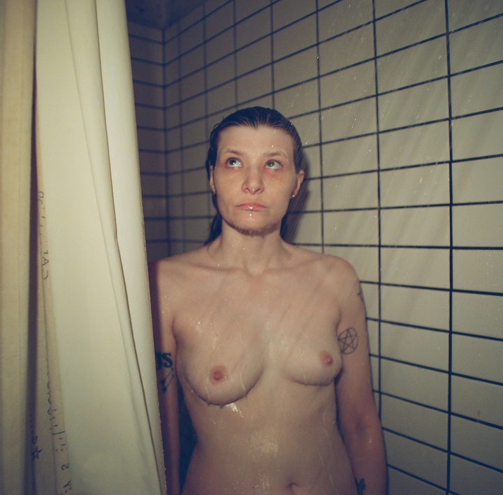  black eye july — photo 3 