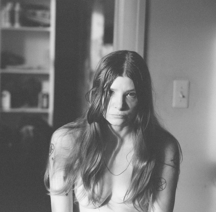  black eye july — photo 6 